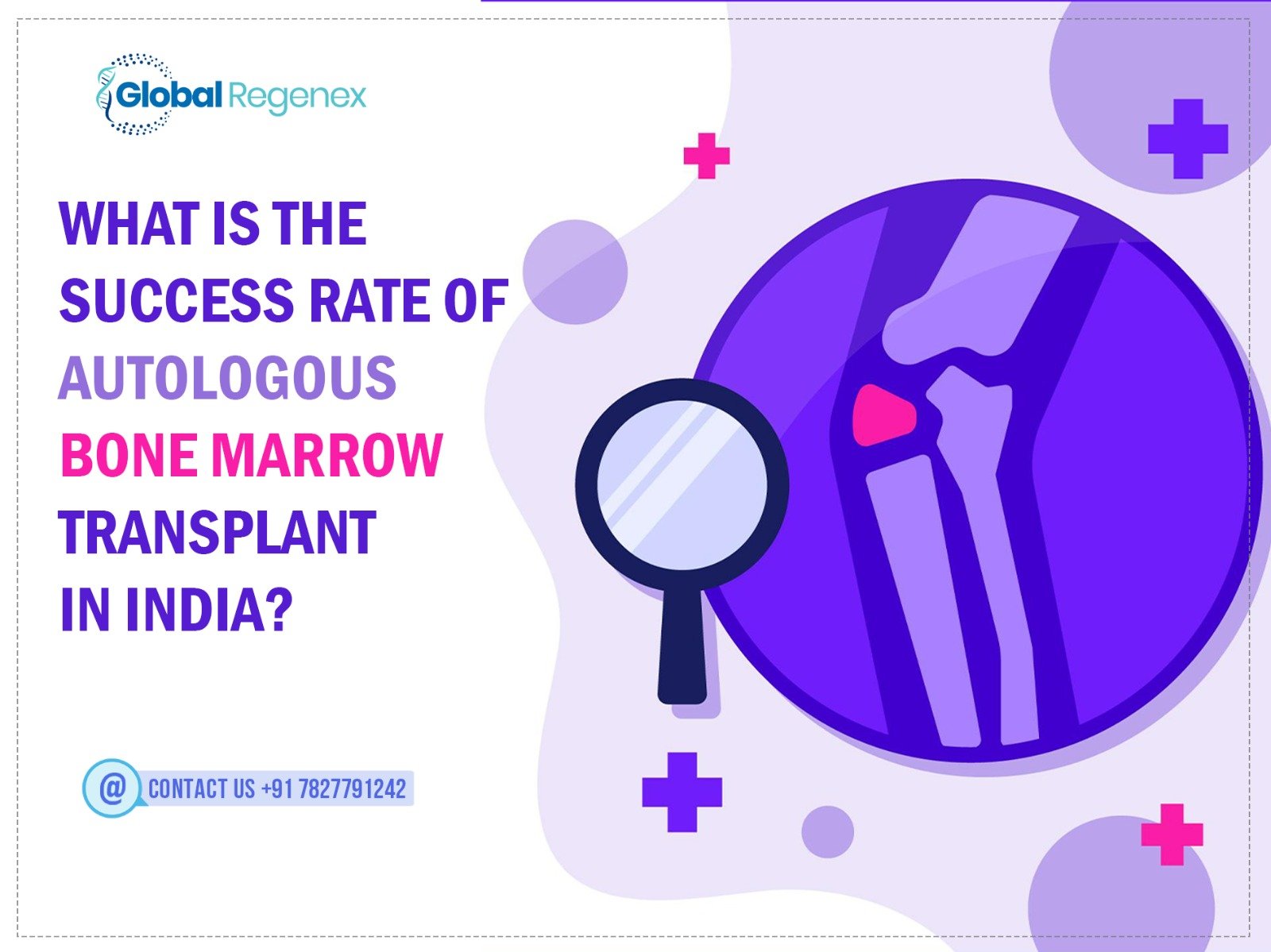 What Is The Success Rate Of Autologous Bone Marrow Transplant In India?