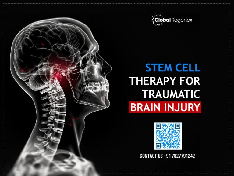 Stem Cell Therapy for Traumatic Brain Injury