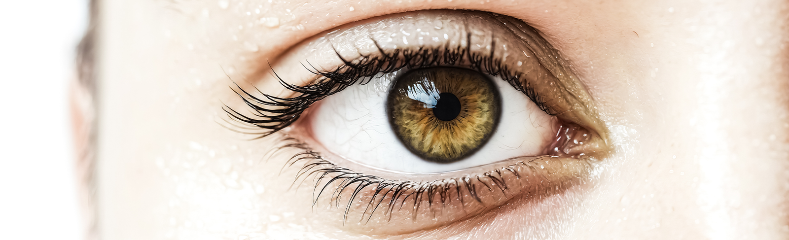 Glaucoma Disease