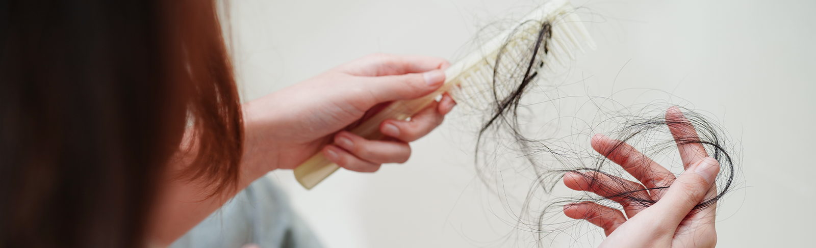 Hair Loss