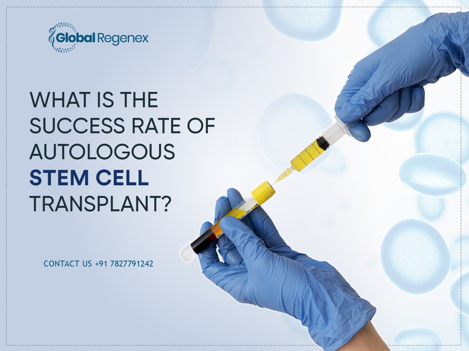 What Is the Success Rate of Autologous Stem Cell Transplant?