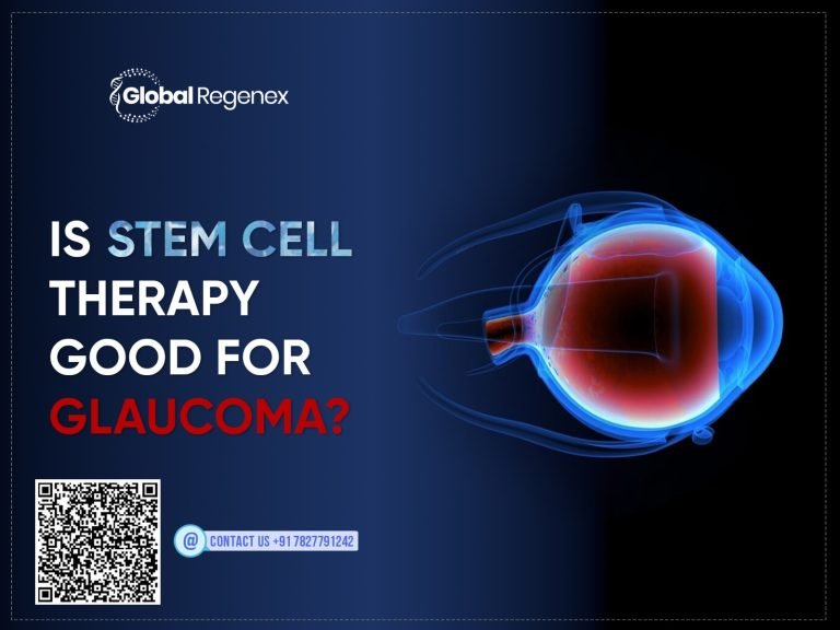 Is Stem Cell Therapy Good for Glaucoma?