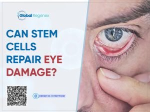 Can Stem Cells Repair Eye Damage?