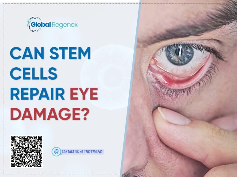 Can Stem Cells Repair Eye Damage?