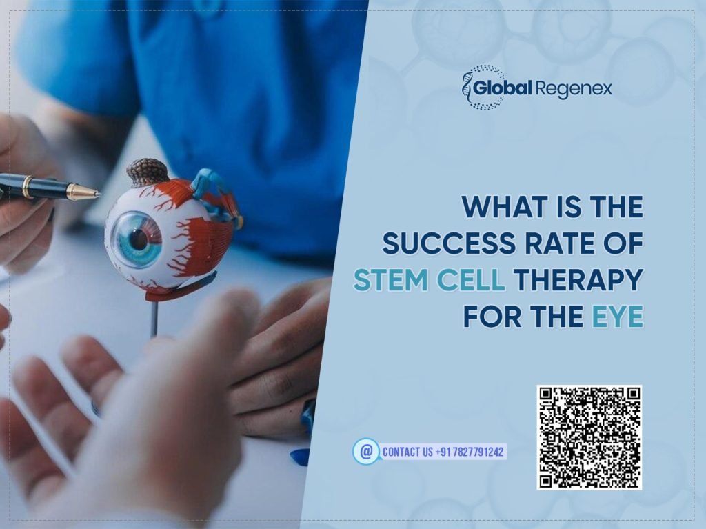 What is the Success Rate of Stem Cell Therapy for the Eye?