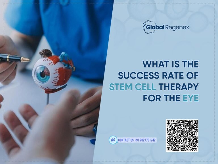 What is the Success Rate of Stem Cell Therapy for the Eye?