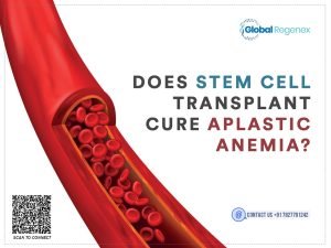 Does Stem Cell Transplant Cure Alpastic Anemia?