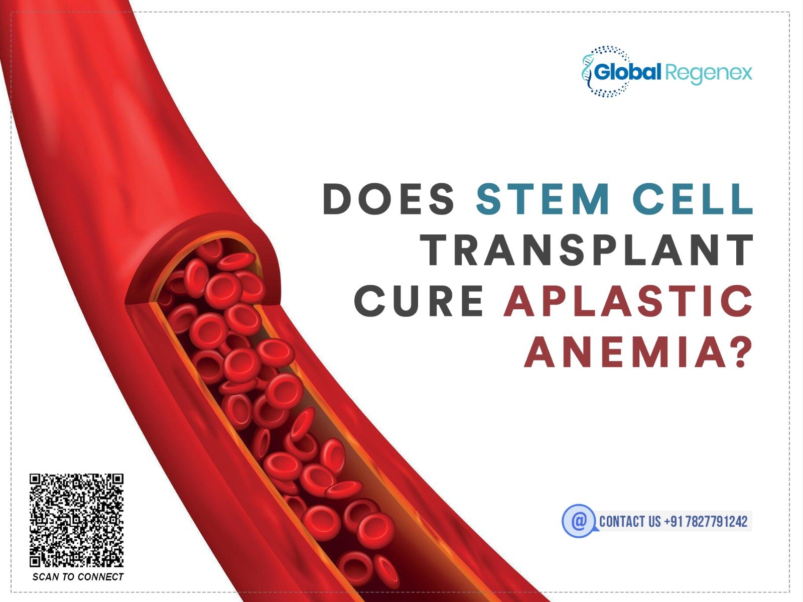 Does Stem Cell Transplant Cure Alpastic Anemia?