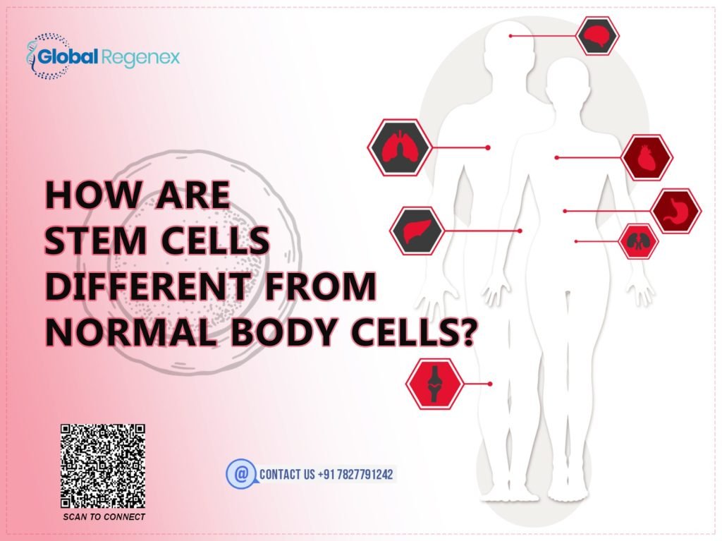 How Are Stem Cells Different From Normal Body Cells?
