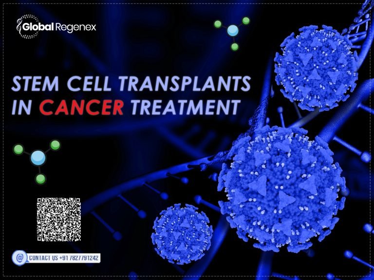 Stem Cell Transplants in Cancer Treatment