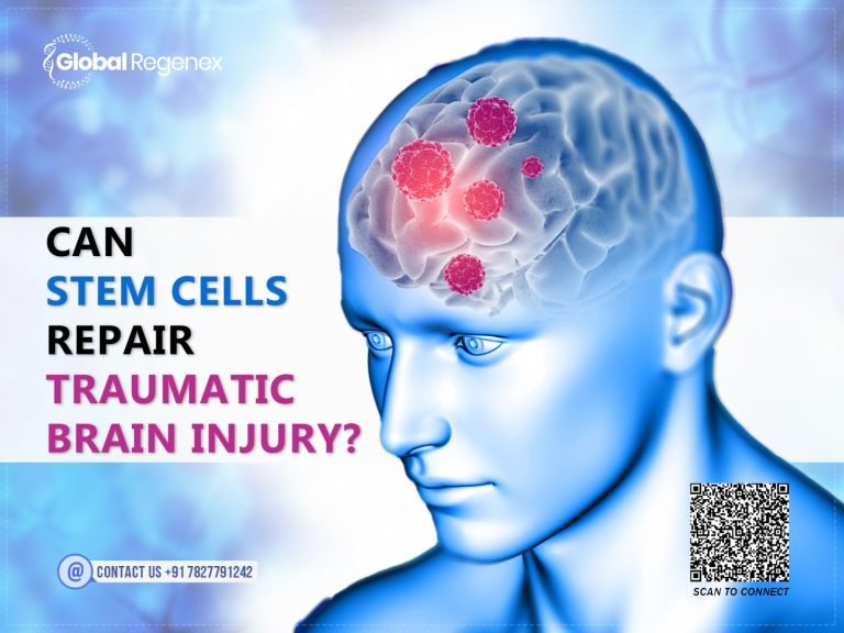 Can Stem Cells Repair Traumatic Brain Injury?