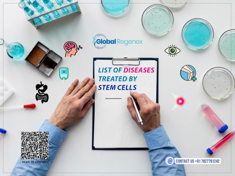 List of Diseases Treated by Stem Cells