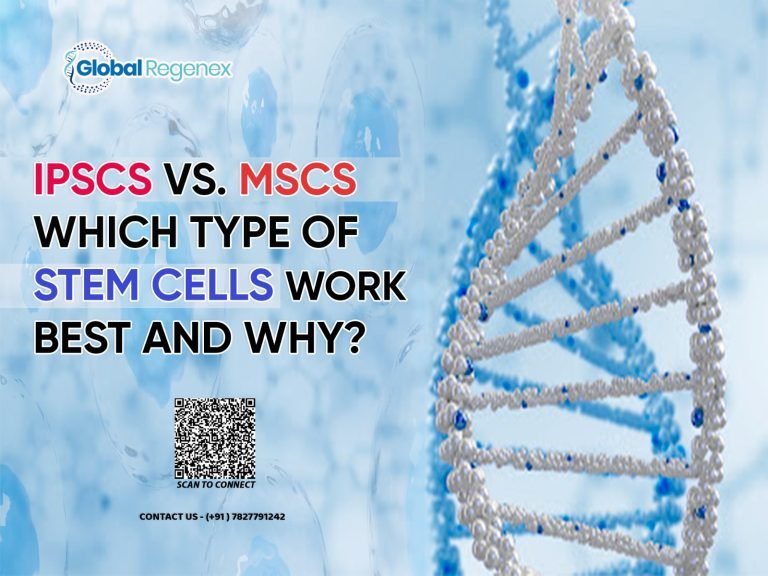 iPCs vs. MSCs: Which Type of Stem Cells Works Best and Why?