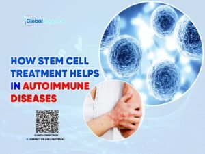 How Stem Cell Treatment Helps in Autoimmune Diseases?