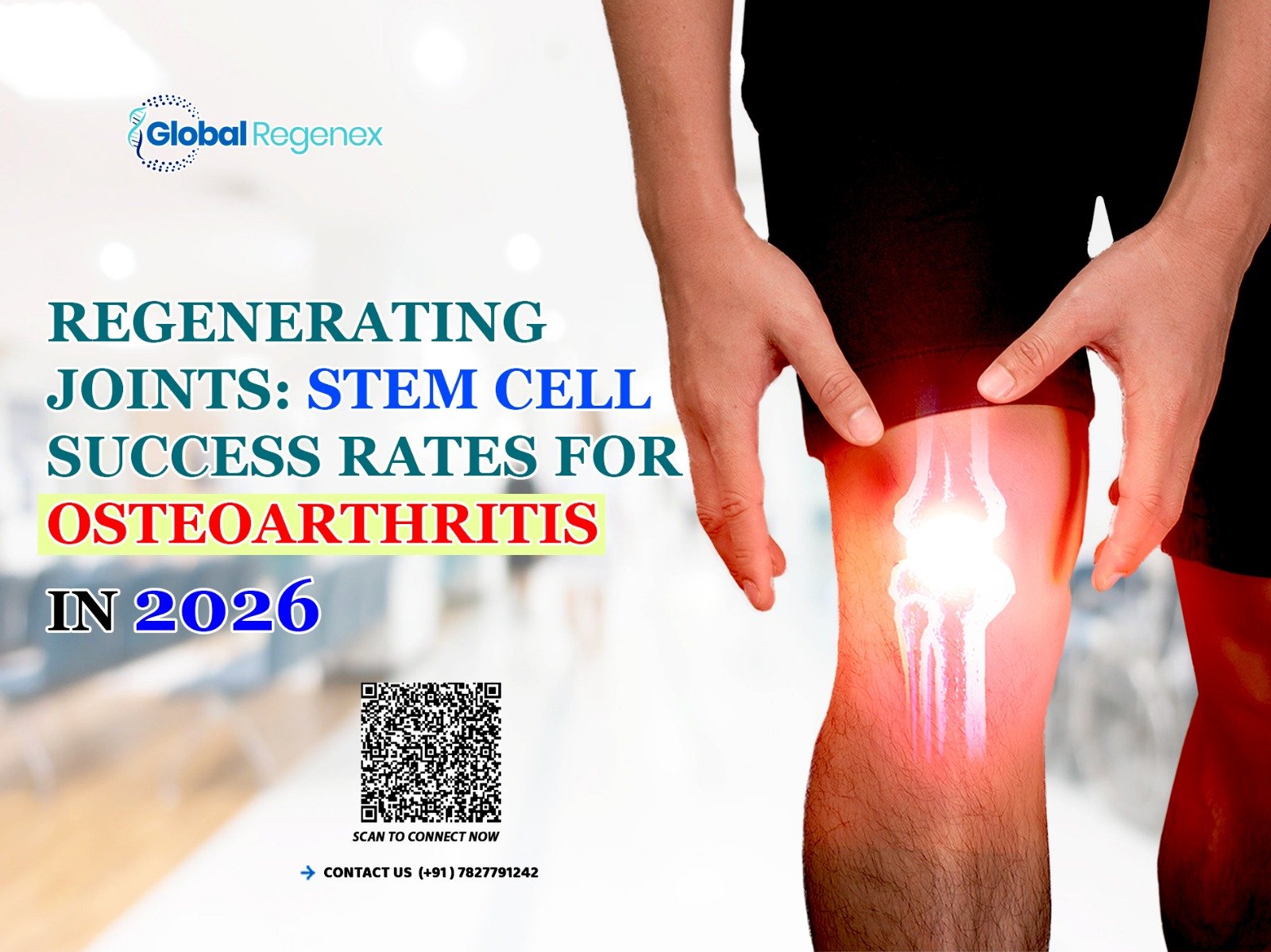 Regenerating Joints: Stem Cell Success Rates for Osteoarthritis in 2026