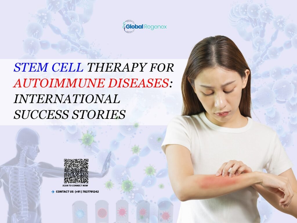 Stem Cell Therapy for Autoimmune Diseases: International Success Stories