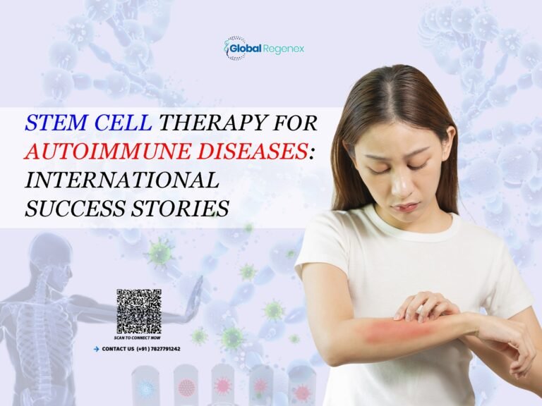 Stem Cell Therapy for Autoimmune Diseases: International Success Stories