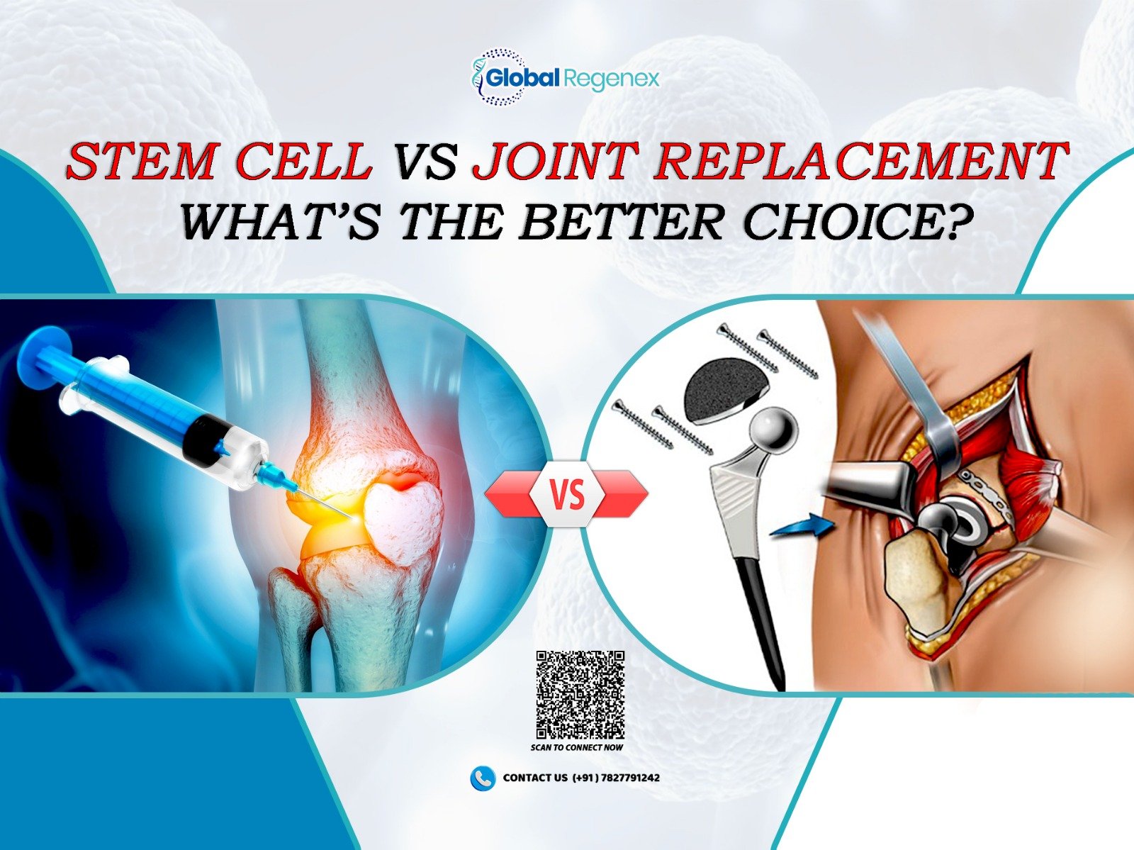 Stem Cell vs Joint Replacement: What’s the Better Choice?