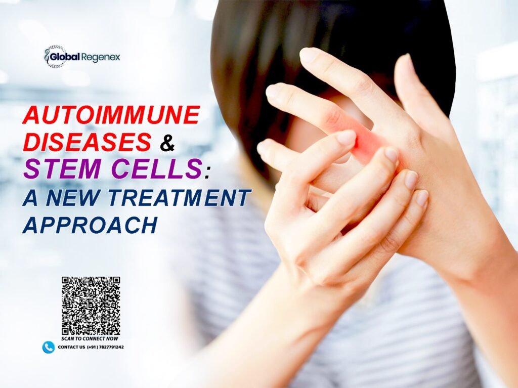 Autoimmune Diseases & Stem Cells